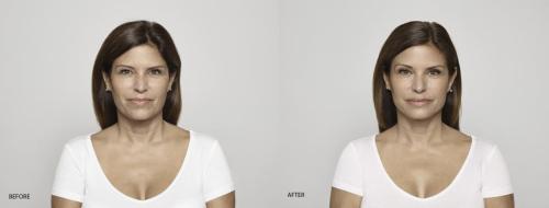Victoria-Before-and-AFTER